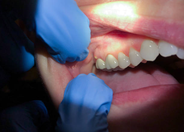 Best Emergency Dentist for Special Needs Patients in Marion, VA