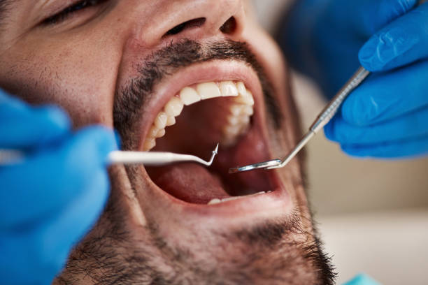 Best Orthodontic Emergency Dentist in Marion, VA