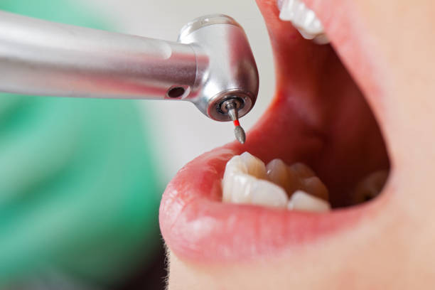 Best Pediatric Emergency Dentist in Marion, VA